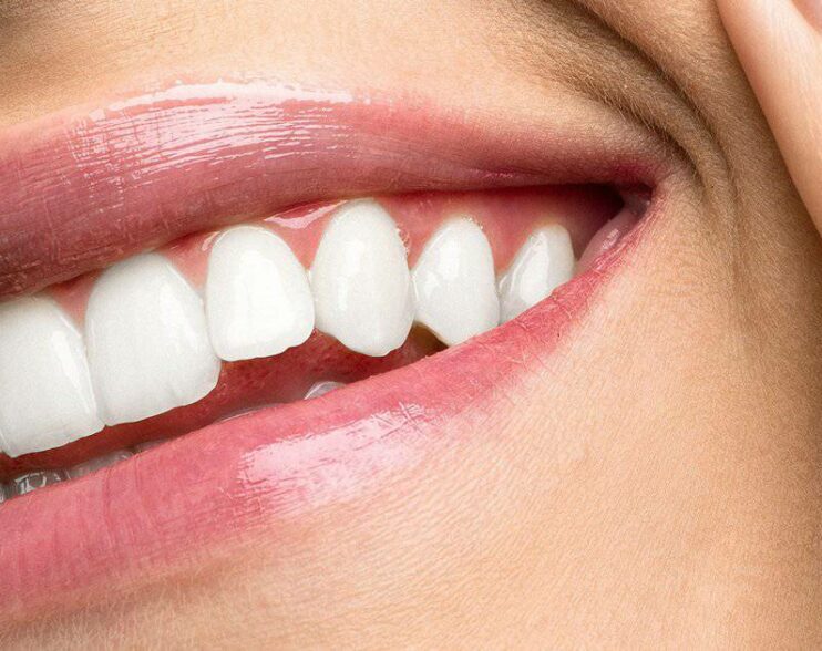 Dişlerin Beyaz Olması İçin Doğal Yöntemler